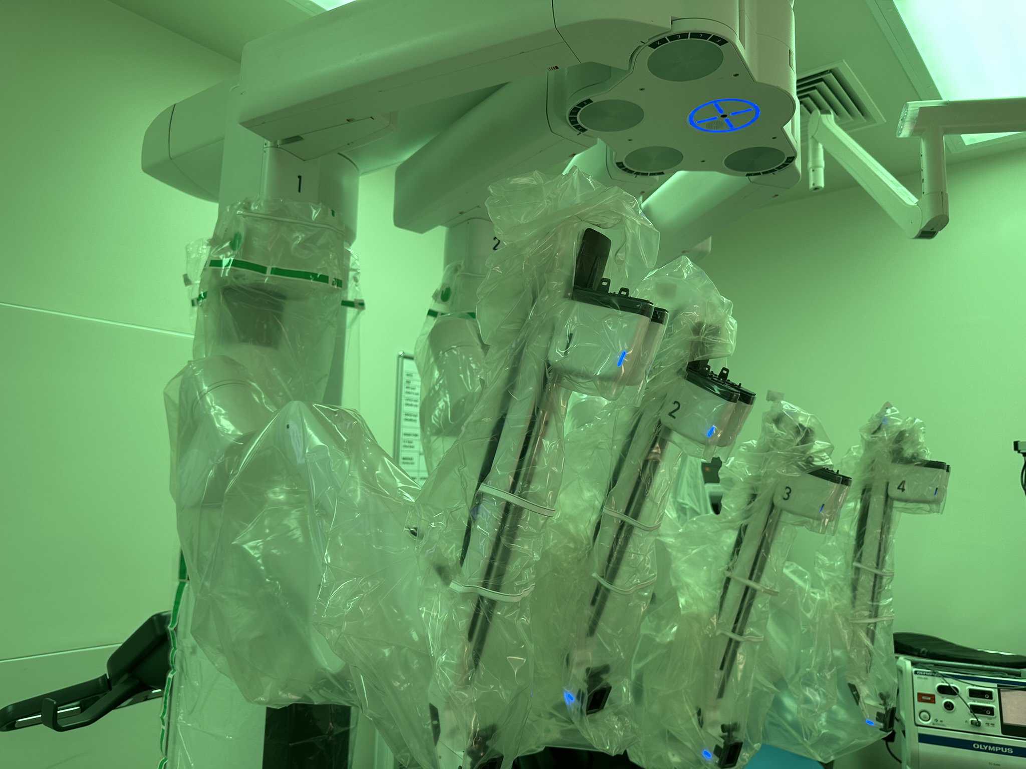 Tamic Injection First robotic TAMIS surgery performed in Birmingham and Black Country ...