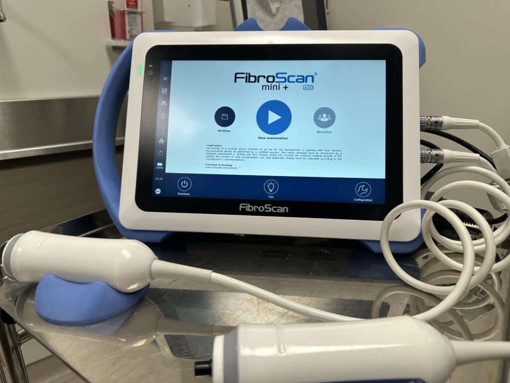 An ultrasound machine called a Fibroscan.